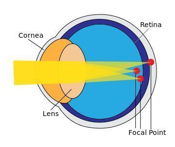 Can I Get RX Goggles for Astigmatism? RX swimming goggles